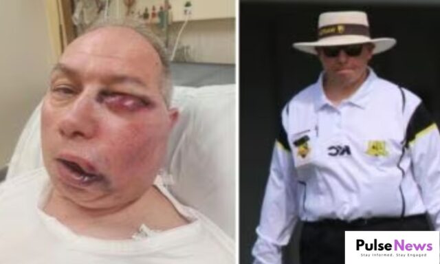 Australian Umpire Injured After Cricket Ball Strikes Face During Local Match Pulse News