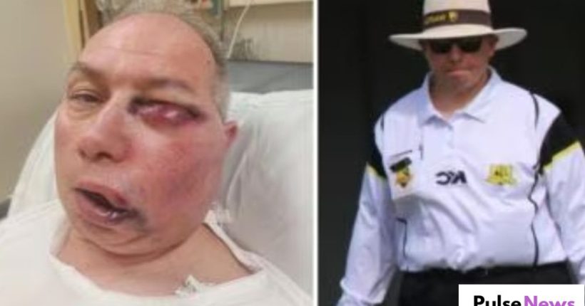 Australian Umpire Injured After Cricket Ball Strikes Face During Local Match Pulse News Australian Umpire Injured After Cricket Ball Strikes Face During Local Match Pulse News
